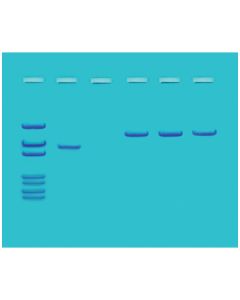 Edvotek DNA Screening for Smallpox [80172]