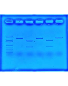 Edvotek Using CRISPR to Treat Cystic Fibrosis [80175]