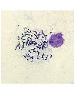 Edvotek Chromosome Spread (Pre-fixed Slides) [80376]