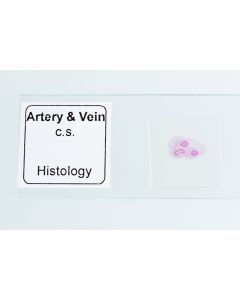 Microscope Slide - Artery & Vein [0408]