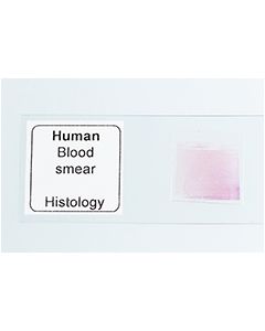 Microscope Slide - Blood Smear [0409]